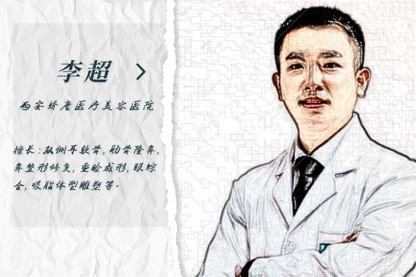 李超