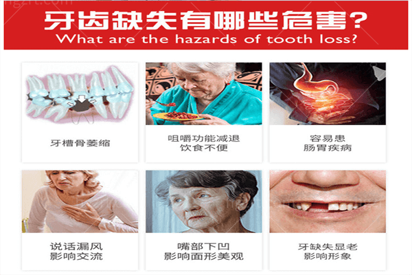 告诉你上海的靠谱牙科有哪些！上海雅悦口腔的口碑你要知道！