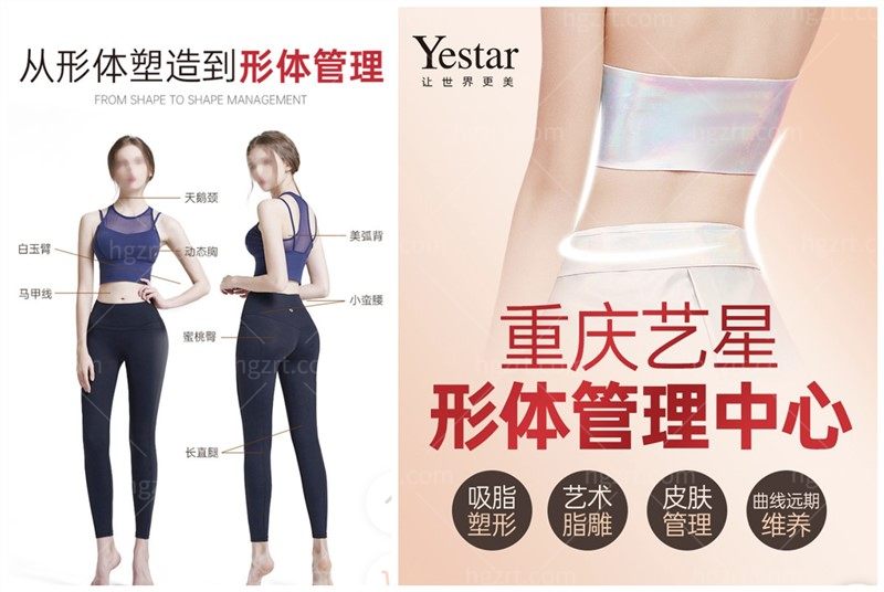 重庆艺星全身吸脂1+3限时优惠