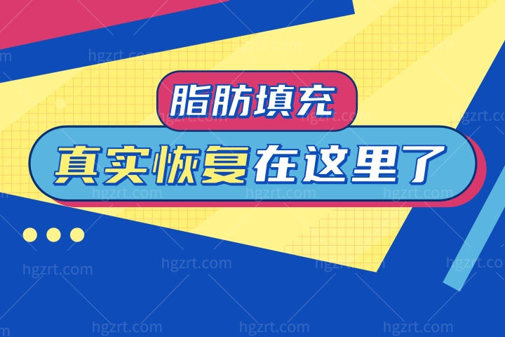 脂肪填充真实期图片，我的照片都在这里了。