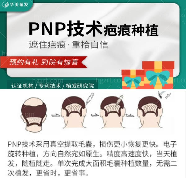 沈阳华美植发PNP技术疤痕种植