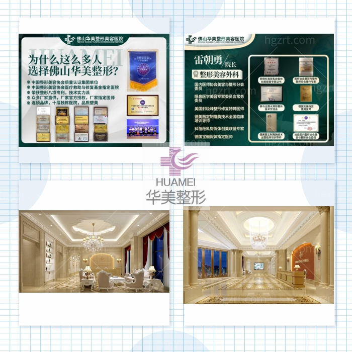 佛山华美【鼻综合】索康膨体隆鼻＋耳软骨＋鼻小柱
