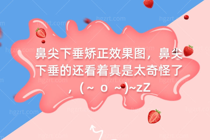 鼻尖下垂矫正反应图，鼻尖下垂的还看着真是太奇怪了，(～ o ～)~zZ