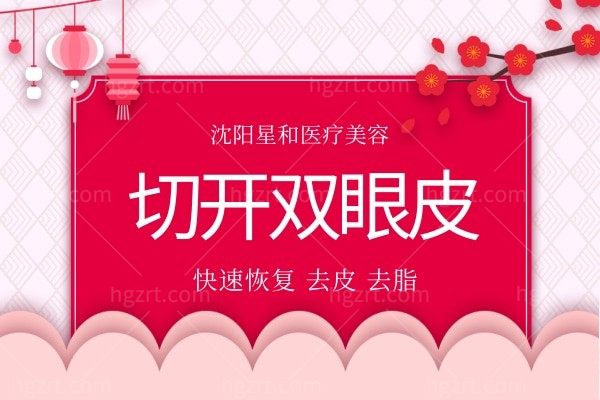 沈阳星和医疗美容-切开双眼皮