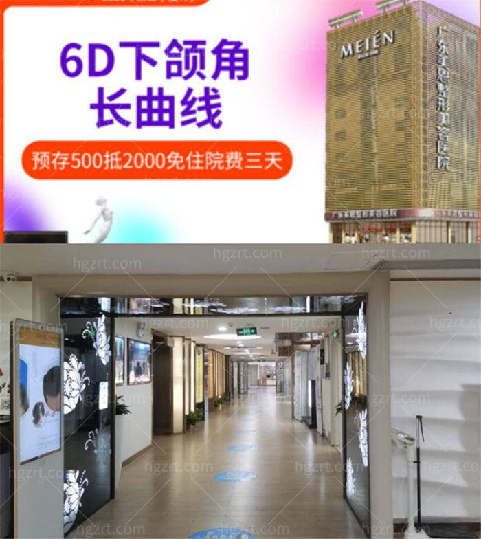 广东美恩整形美容医院下颌角整形特惠