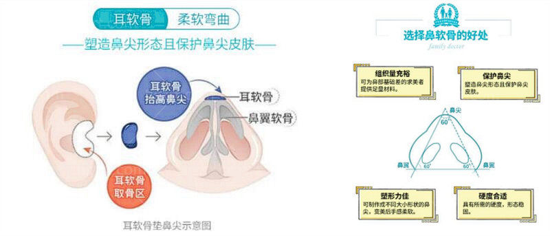 广州中家医家庭整形医院靠谱吗