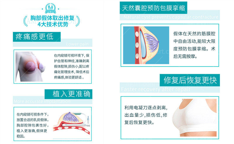 广州中家医家庭整形医院隆胸修复手术