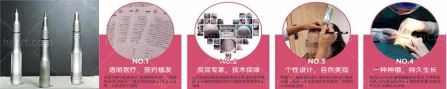 重庆正规植发医院名单