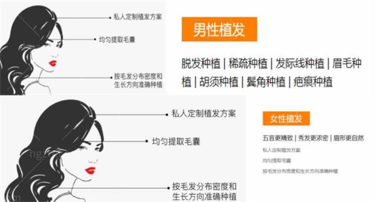 重庆正规植发医院名单