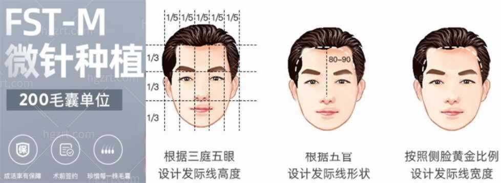 昆明植发医院排名
