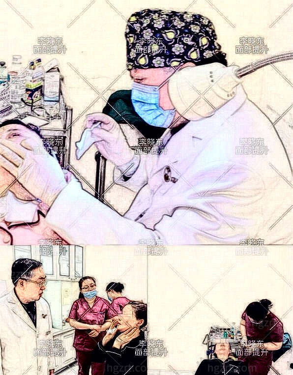 国内拉皮手术医生排名-李晓东