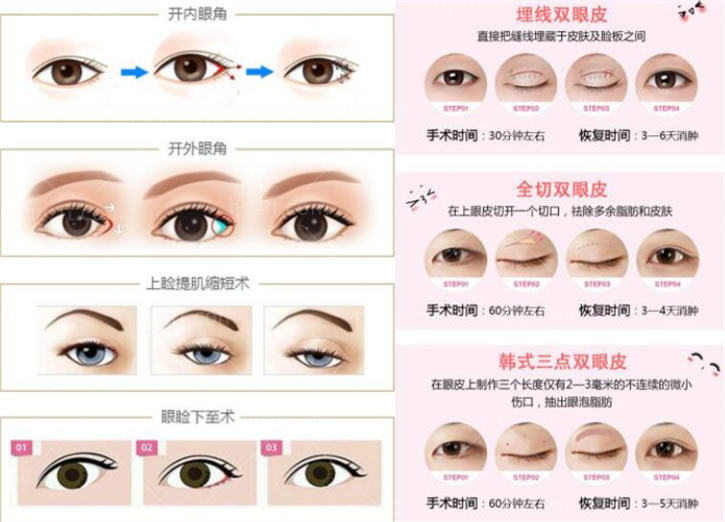 芭芘大眼综合项目包括