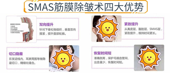 up!国内做面部提升好的的医生都有谁？让脸部提升紧致的方法非SMAS莫属！