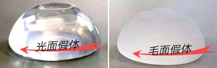 假体隆胸.jpg
