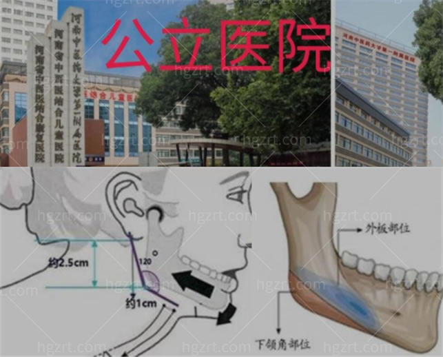 郑州有没有做下颌骨的医院