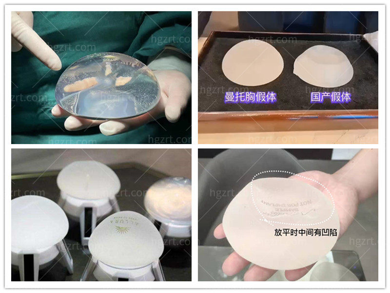 假体隆胸材质 假体隆胸材质