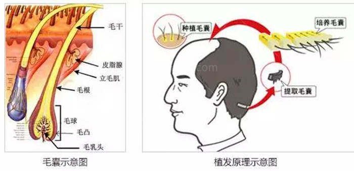 珠海市比较好的植发医院排行