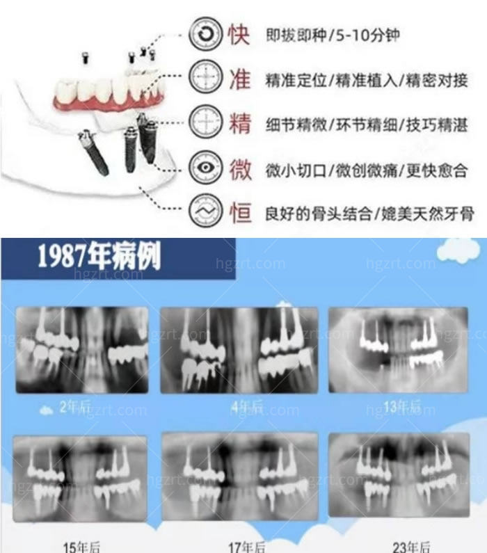 上海罗缘口腔整牙种植牙收费价格表