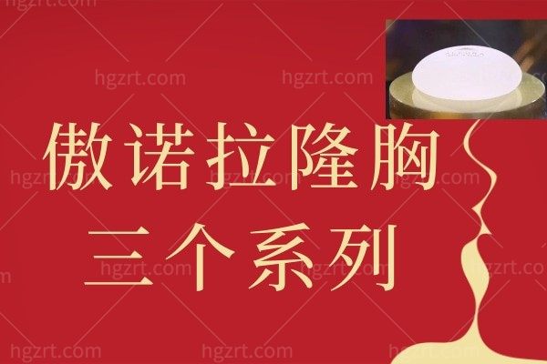 傲诺拉三个系列怎么区分