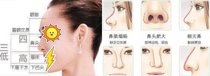 南京康美美容医院冯思阳好不好