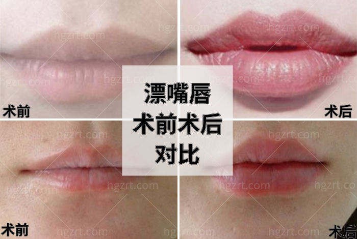 漂嘴唇.jpg
