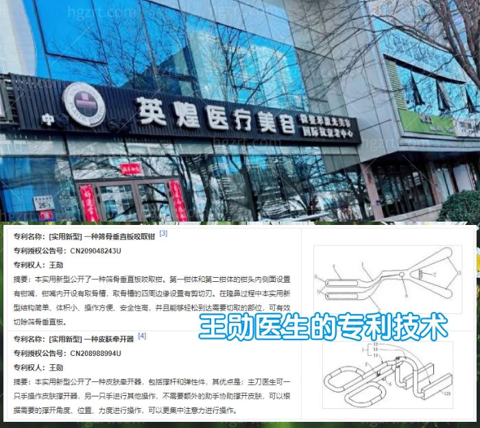 在北京英煌医院做自体脂肪丰胸太棒了！上榜北京自体脂肪丰胸排名前十的医院就是不一样！