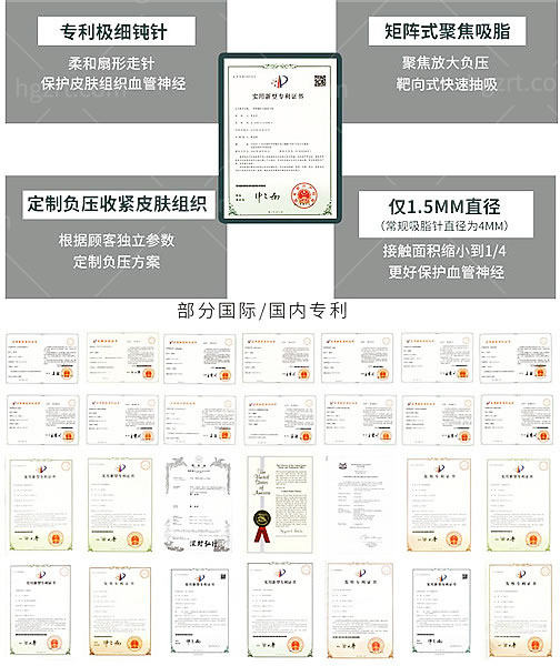 哪个医院有土麦森吸脂?技术成熟吗?网友反馈土麦森吸脂不用穿塑身衣<span style=