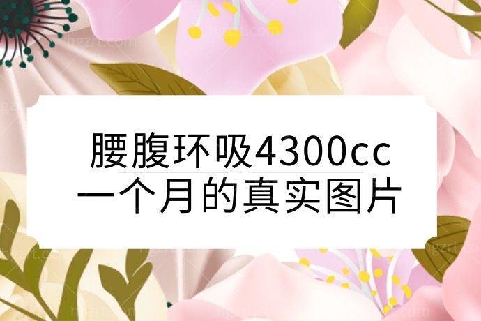 腰腹环吸需要注意什么