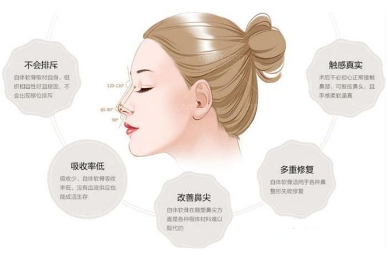 隆鼻的假体可以放一辈子吗