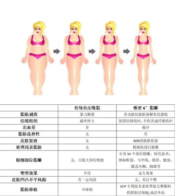 维密6°脂雕吸脂和传统吸脂的区别