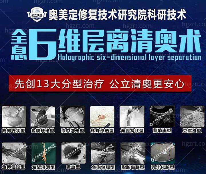 广州取奥美定哪个医院好 广州清奥医生推荐