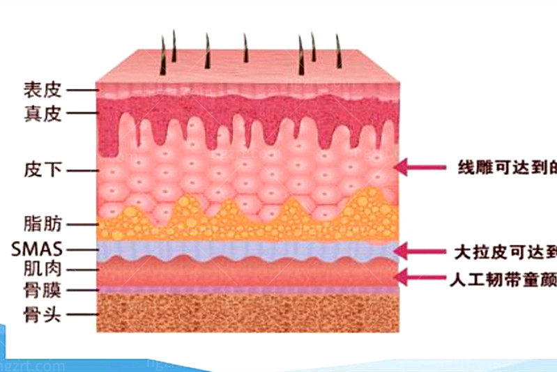 7d聚拉提和热玛吉分别适合哪种人群