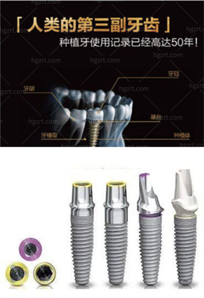 上海种植牙哪家医院好 医院排名前十名单告诉你答案