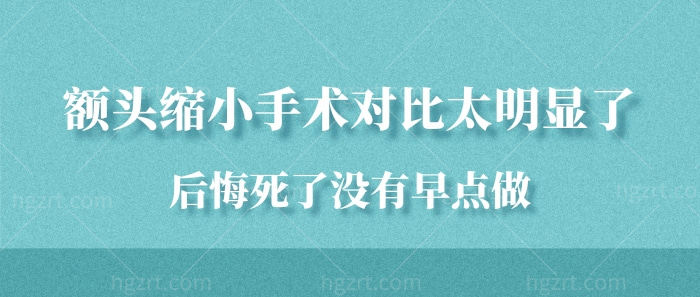 额头缩小手术对比太明显了！后悔死了没有早点做！