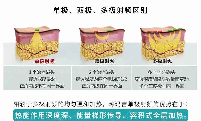 什么？厦门脸博士的热玛吉价格不到9800？这是让我白嫖吗？