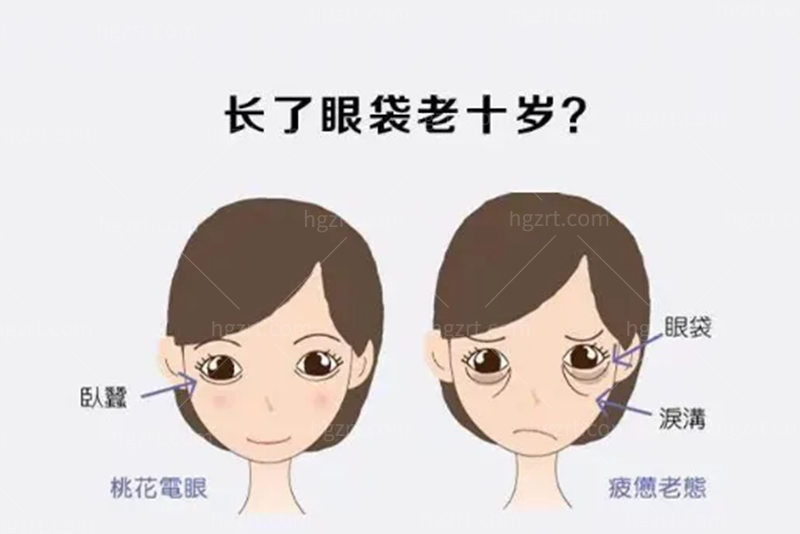 上海金云波的眼袋手术做的好吗