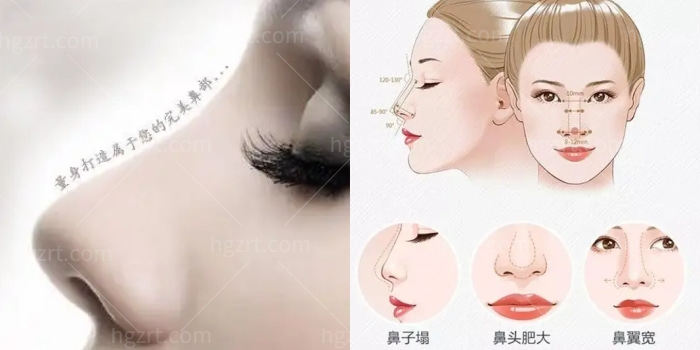 曝！西安鼻整形医生排名公布！这些鼻整形有名的医生速看！