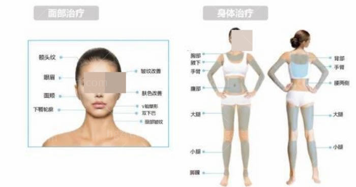 聚拉提到底哪里可以做