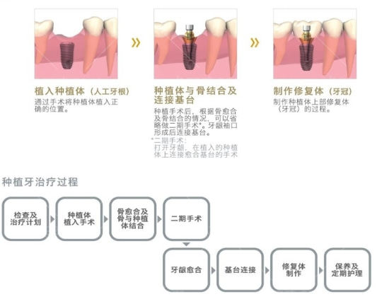 广州市种牙医院排行榜前十