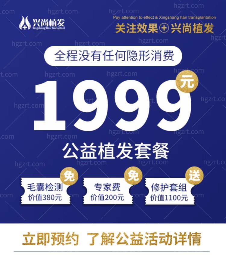 青岛兴尚植发医院五月太可了，我要赶紧去植发让头发蓬起来