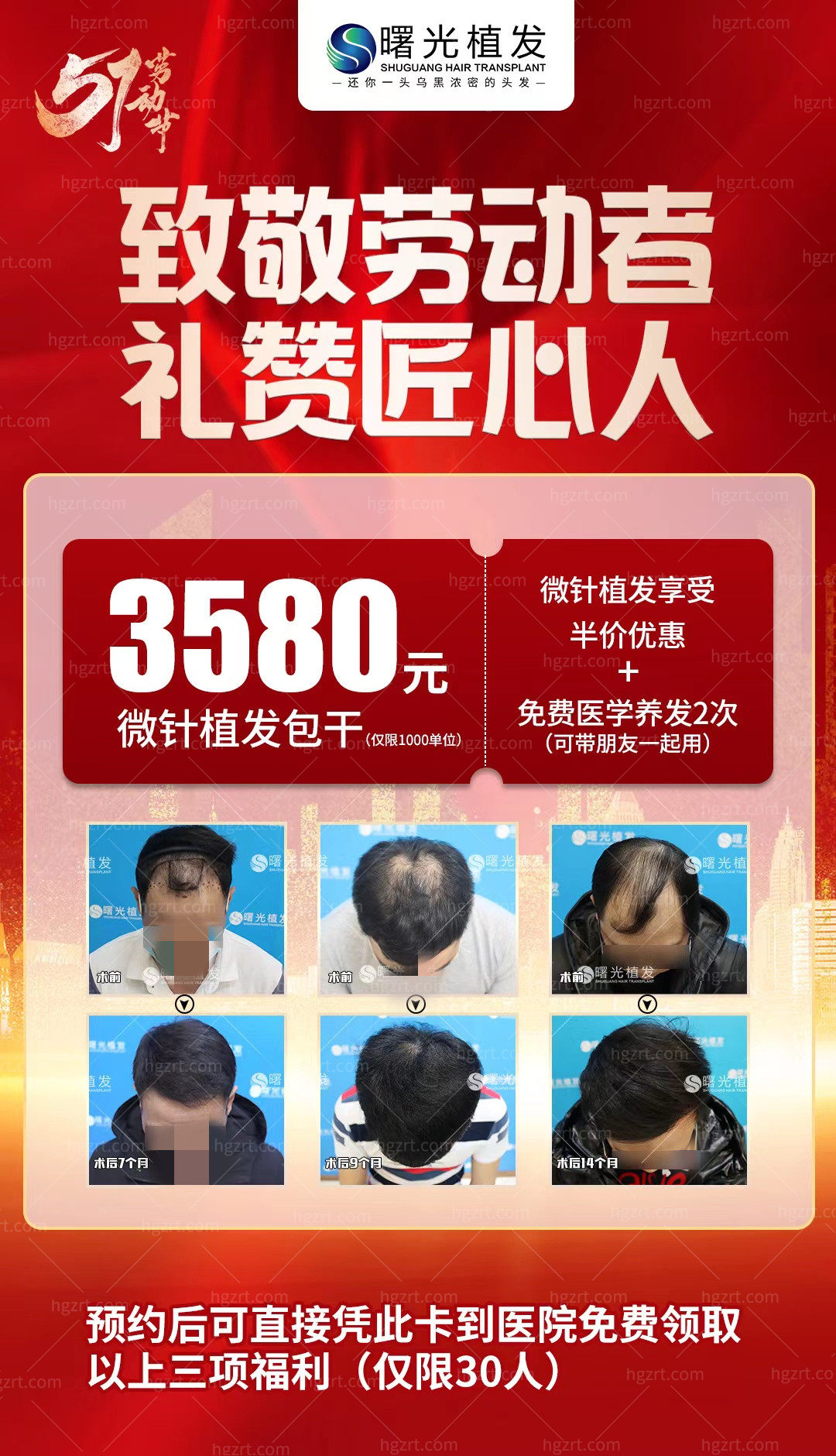 曙光金子植发(植发十大品牌排行榜)