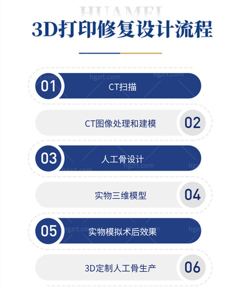 3D打印技术修补下颌角的流程