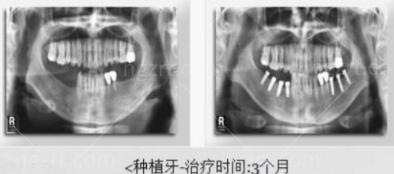 韩国多仁牙科 韩国多仁牙科