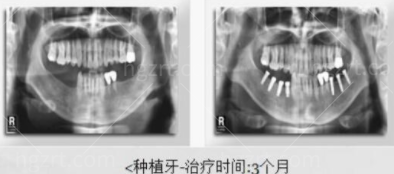 韩国多仁牙科