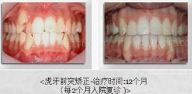 韩国多仁牙科