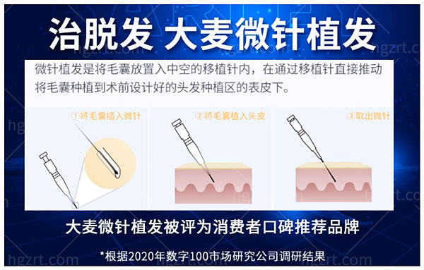 2024年广州市植发医院排行榜发布:榜单靠前且口碑好的四家做植发个个在行