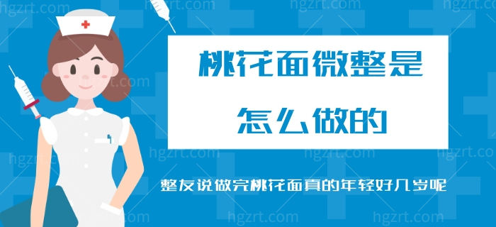 桃花面微整是怎么做的 整友说做完桃花面真的年轻好几岁呢