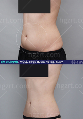 韩国安瑟琳整形外科