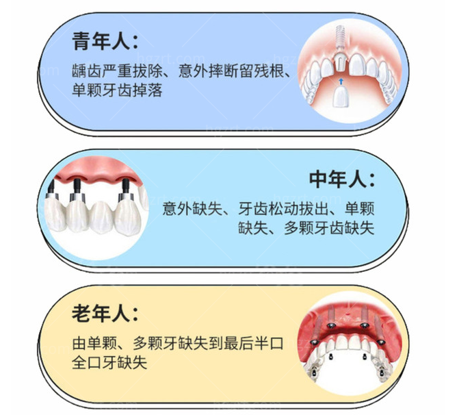 哪些人需要做种植牙