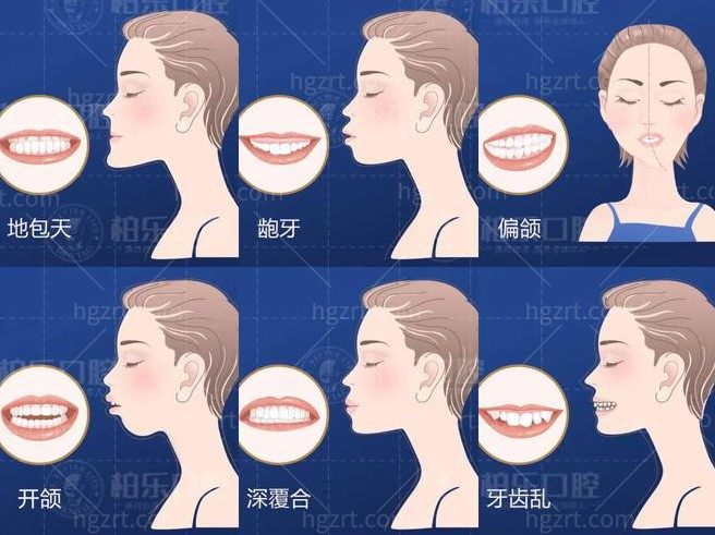 牙齿矫正